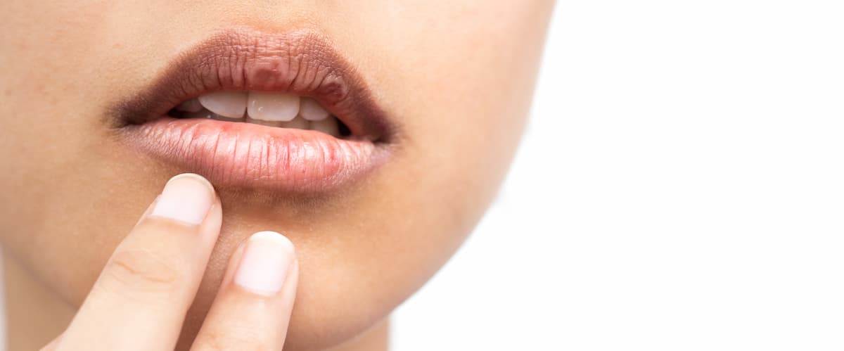 أسباب جفاف الجلد حول الفم